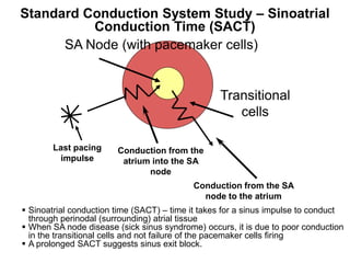Standard Conduction System Study – Sinoatrial
           Conduction Time (SACT)
       SA Node (with pacemaker cells)


                                                   Transitional
                                                      cells

        Last pacing      Conduction from the
         impulse          atrium into the SA
                                node
                                            Conduction from the SA
                                              node to the atrium
  Sinoatrial conduction time (SACT) – time it takes for a sinus impulse to conduct
   through perinodal (surrounding) atrial tissue
  When SA node disease (sick sinus syndrome) occurs, it is due to poor conduction
   in the transitional cells and not failure of the pacemaker cells firing
  A prolonged SACT suggests sinus exit block.
81
 