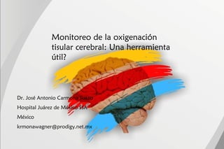 Monitoreo de la oxigenación
tisular cerebral: Una herramienta
útil?
Dr. José Antonio Carmona Suazo
Hospital Juárez de México SSA
México
krmonawagner@prodigy.net.mx
 
