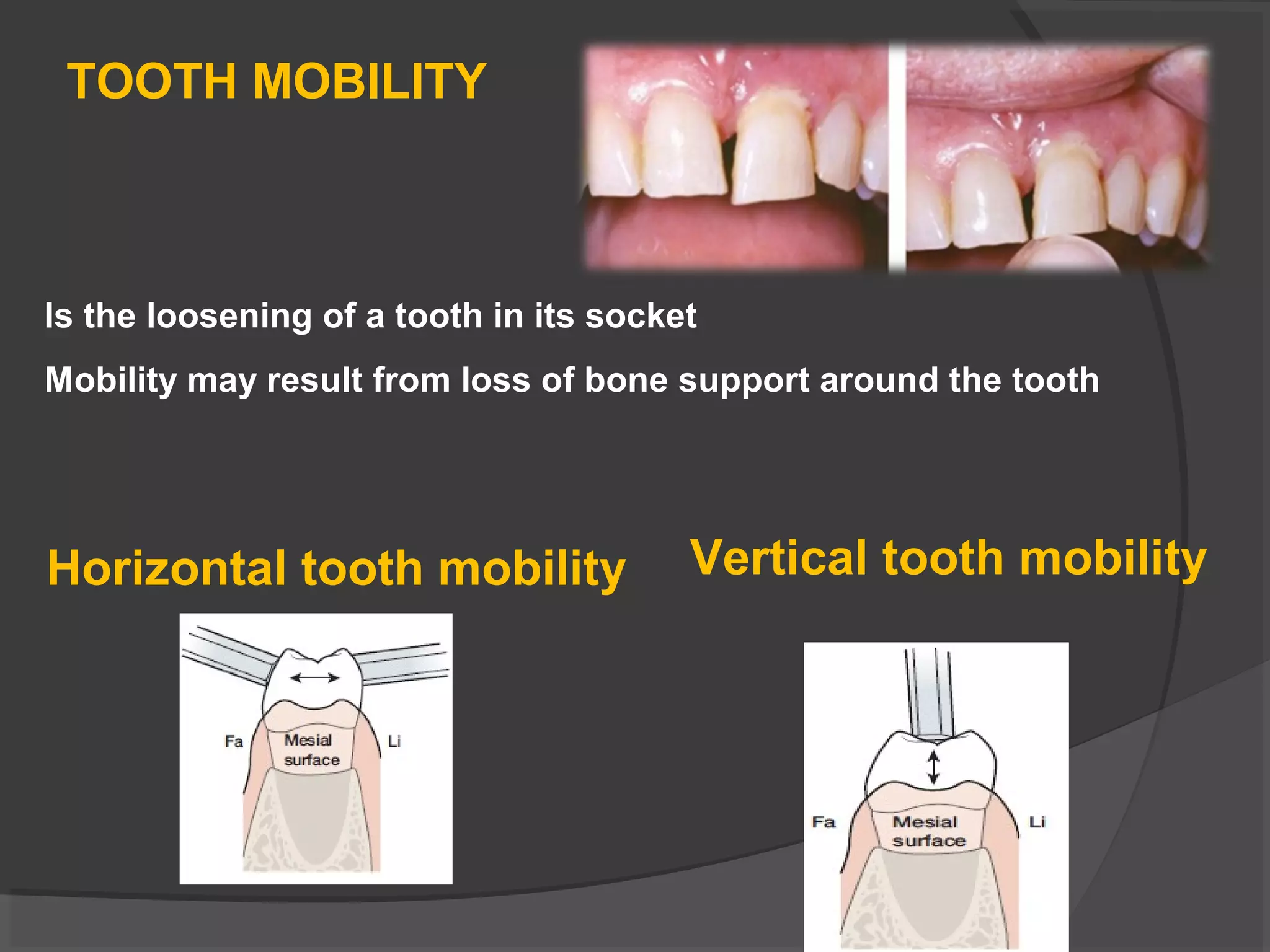 Periodontal examination and diagnosis | PPT