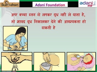 Exclusive Breast Feeding During 1st 6 months