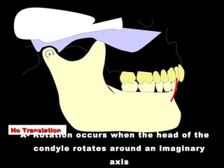No TranslationNo Translation
A- Rotation occurs when the head of the
condyle rotates around an imaginary
axis
 