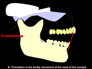TranslationTranslation
B. Translation is the bodily movement of the head of the condyle
 