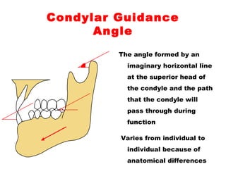 Condylar Guidance
Angle
The angle formed by an
imaginary horizontal line
at the superior head of
the condyle and the path
that the condyle will
pass through during
function
Varies from individual to
individual because of
anatomical differences
 