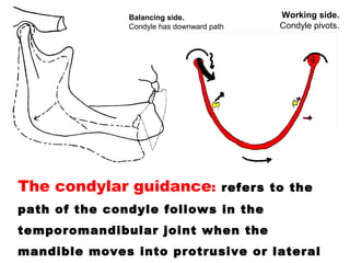 The condylar guidance: refers to the
path of the condyle follows in the
temporomandibular joint when the
mandible moves into protrusive or lateral
Balancing side.
Condyle has downward path
Working side.
Condyle pivots.
 