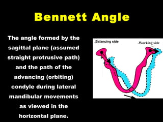 Bennett AngleBennett Angle
The angle formed by the
sagittal plane (assumed
straight protrusive path)
and the path of the
advancing (orbiting)
condyle during lateral
mandibular movements
as viewed in the
horizontal plane.
Balancing side. Working side.
 
