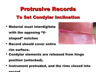 Protrusive RecordsProtrusive Records
To Set Condylar InclinationTo Set Condylar Inclination
 Material must interdigitate
with the opposing “V-
shaped” notches
 Record should cover entire
rim surface.
 Condylar elements are released from hinge
position (unlocked).
 Instrument protruded, and the rims closed into
 