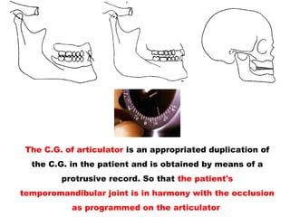 The C.G. of articulator is an appropriated duplication of
the C.G. in the patient and is obtained by means of a
protrusive record. So that the patient's
temporomandibular joint is in harmony with the occlusion
as programmed on the articulator
 