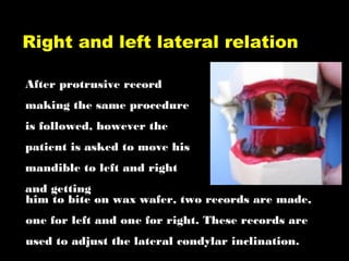 After protrusive record
making the same procedure
is followed, however the
patient is asked to move his
mandible to left and right
and getting
Right and left lateral relation
him to bite on wax wafer, two records are made,
one for left and one for right. These records are
used to adjust the lateral condylar inclination.
 