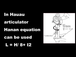 In Hauau
articulator
Hanan equation
can be used
L = H/ 8+ I2
 
