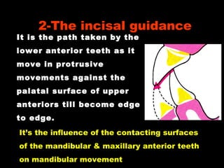 It is the path taken by the
lower anterior teeth as it
move in protrusive
movements against the
palatal surface of upper
anteriors till become edge
to edge.
2-The incisal guidance
It’s the influence of the contacting surfaces
of the mandibular & maxillary anterior teeth
on mandibular movement
 