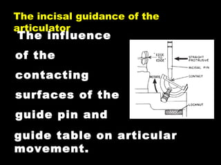 The influence
of the
contacting
surfaces of the
guide pin and
The incisal guidance of the
articulator
guide table on articular
movement.
 
