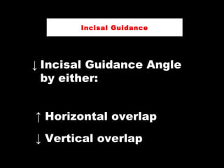↓ Incisal Guidance Angle
by either:
↑ Horizontal overlap
↓ Vertical overlap
Incisal Guidance
 