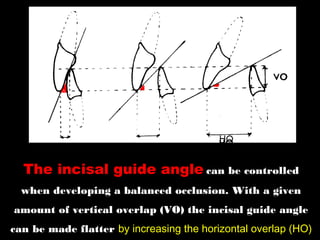 The incisal guide angle can be controlled
when developing a balanced occlusion. With a given
amount of vertical overlap (VO) the incisal guide angle
can be made flatter by increasing the horizontal overlap (HO)
 
