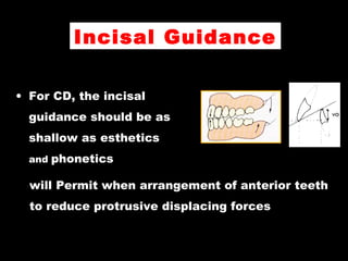 Incisal Guidance
• For CD, the incisal
guidance should be as
shallow as esthetics
and phonetics
will Permit when arrangement of anterior teeth
to reduce protrusive displacing forces
 
