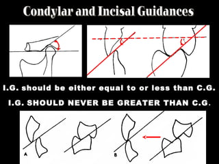 I.G. should be either equal to or less than C.G.
I.G. SHOULD NEVER BE GREATER THAN C.G.
 