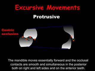 Excursive Movements
Centric
occlusion
Protrusive
The mandible moves essentially forward and the occlusal
contacts are smooth and simultaneous in the posterior
both on right and left sides and on the anterior teeth.
 