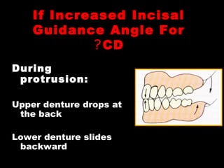 If Increased Incisal
Guidance Angle For
CD?
During
protrusion:
Upper denture drops at
the back
Lower denture slides
backward
 