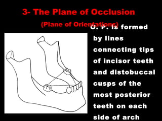 O. P. is formed
by lines
connecting tips
of incisor teeth
and distobuccal
cusps of the
most posterior
teeth on each
side of arch
3- The Plane of Occlusion
(Plane of Orientations)
 
