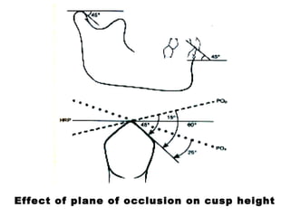 Effect of plane of occlusion on cusp height
 