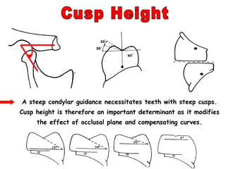 A steep condylar guidance necessitates teeth with steep cusps.
Cusp height is therefore an important determinant as it modifies
the effect of occlusal plane and compensating curves.
 