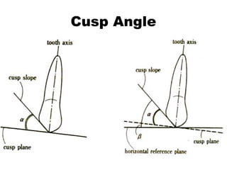 Cusp Angle
 