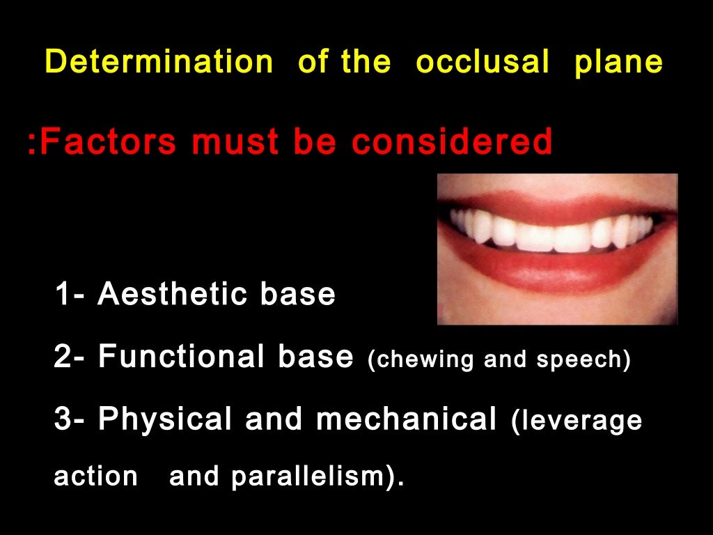 3 Factors affecting balanced occlusion final