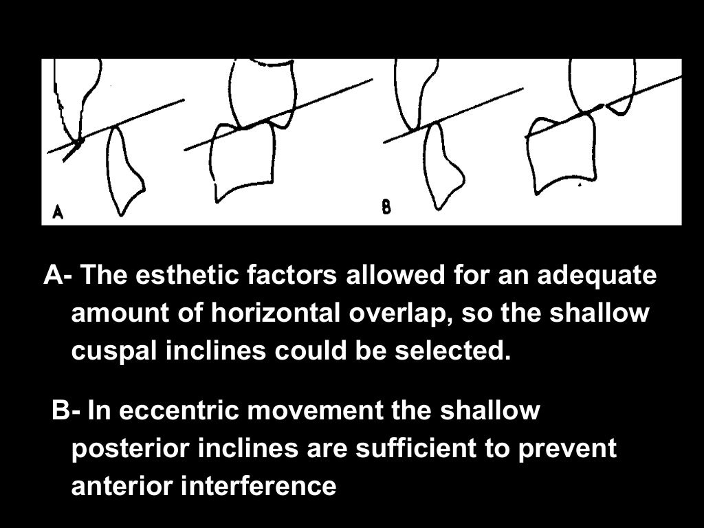 3 Factors affecting balanced occlusion final