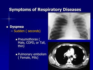 Symptoms of Respiratory Diseases
◼ Dyspnea
– Sudden ( seconds)
◼ Pneumothorax (
Male, COPD, or Tall,
thin)
◼ Pulmonary embolism
( Female, Pills)
 