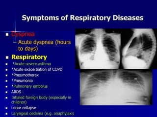 Symptoms of Respiratory Diseases
◼ Dyspnea
– Acute dyspnea (hours
to days)
◼ Respiratory
◼ *Acute severe asthma
◼ *Acute exacerbation of COPD
◼ *Pneumothorax
◼ *Pneumonia
◼ *Pulmonary embolus
◼ ARDS
◼ Inhaled foreign body (especially in
children)
◼ Lobar collapse
◼ Laryngeal oedema (e.g. anaphylaxis
 