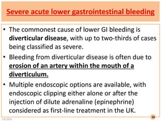 Severe acute lower gastrointestinal bleeding
• The commonest cause of lower GI bleeding is
diverticular disease, with up to two-thirds of cases
being classified as severe.
• Bleeding from diverticular disease is often due to
erosion of an artery within the mouth of a
diverticulum.
• Multiple endoscopic options are available, with
endoscopic clipping either alone or after the
injection of dilute adrenaline (epinephrine)
considered as first-line treatment in the UK.
7/6/2024
16
 