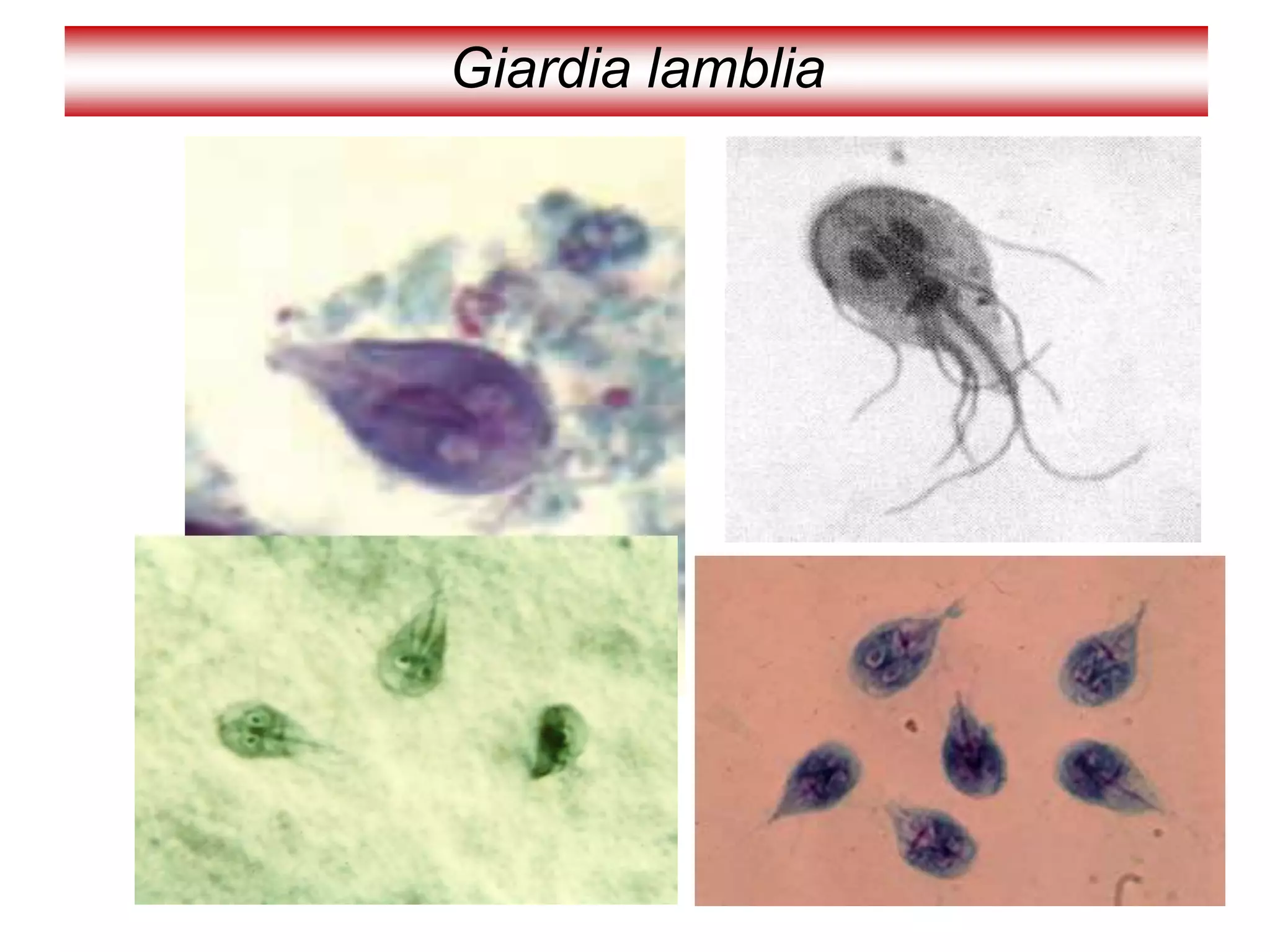 Giardia lamblia
 