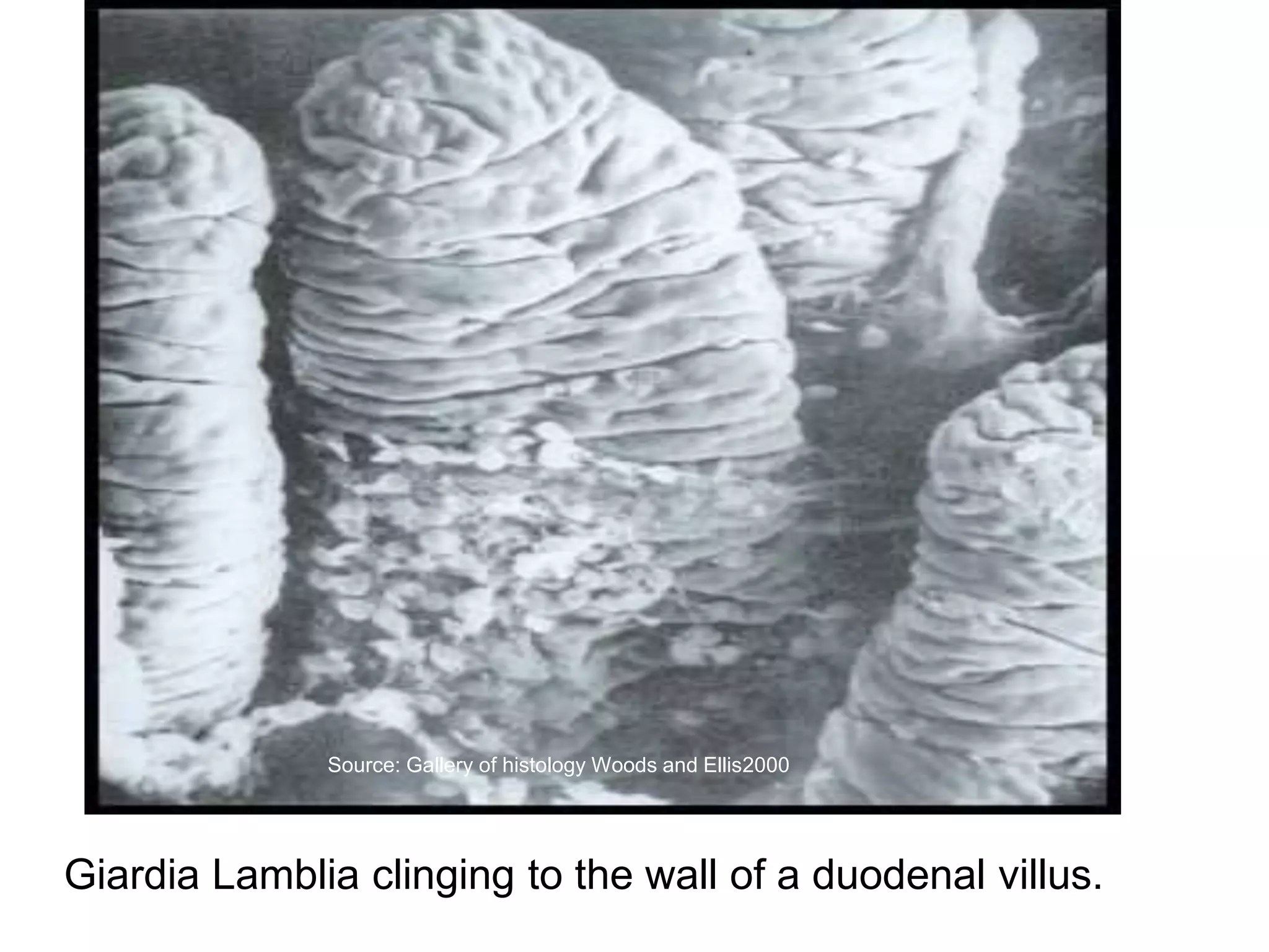 Giardia Lamblia clinging to the wall of a duodenal villus.
Source: Gallery of histology Woods and Ellis2000
 