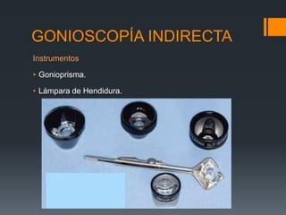GONIOSCOPÍA INDIRECTA
Instrumentos

• Gonioprisma.

• Lámpara de Hendidura.
 