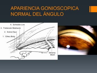APARIENCIA GONIOSCOPICA
NORMAL DEL ÁNGULO
 