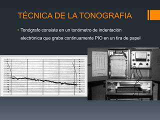 TÉCNICA DE LA TONOGRAFIA
• Tonógrafo consiste en un tonómetro de indentación
 electrónica que graba continuamente PIO en un tira de papel
 