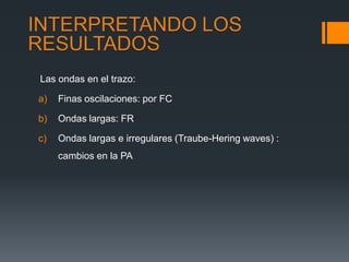 Las ondas en el trazo:

a)   Finas oscilaciones: por FC

b)   Ondas largas: FR

c)   Ondas largas e irregulares (Traube-Hering waves) :
     cambios en la PA
 