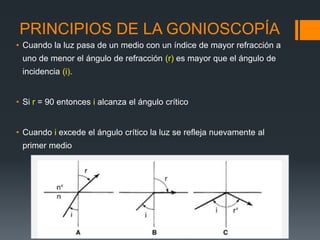 PRINCIPIOS DE LA GONIOSCOPÍA
• Cuando la luz pasa de un medio con un índice de mayor refracción a
 uno de menor el ángulo de refracción (r) es mayor que el ángulo de
 incidencia (i).


• Si r = 90 entonces i alcanza el ángulo crítico


• Cuando i excede el ángulo crítico la luz se refleja nuevamente al
 primer medio
 