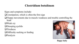 Clostridium botulinum
Signs and symptoms include:
Constipation, which is often the first sign
Floppy movements due to muscle weakness and trouble controlling the
head
Weak cry
Drooping eyelids
Tiredness
Difficulty sucking or feeding
Paralysis
floppy baby
 