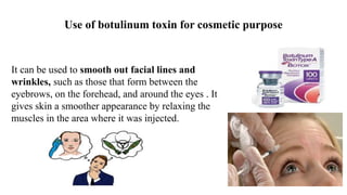 Use of botulinum toxin for cosmetic purpose
It can be used to smooth out facial lines and
wrinkles, such as those that form between the
eyebrows, on the forehead, and around the eyes . It
gives skin a smoother appearance by relaxing the
muscles in the area where it was injected.
 