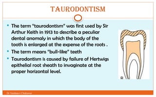Bull Tooth GROWTH AND DEVELOPMENT OF TEETH AND DENTAL ANOMALIES.pptx