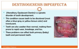 GROWTH AND DEVELOPMENT OF TEETH AND DENTAL ANOMALIES.pptx