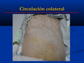 Circulación colateral
 