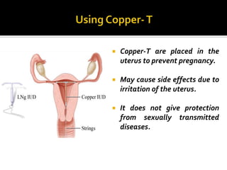    Copper-T are placed in the
    uterus to prevent pregnancy.

   May cause side effects due to
    irritation of the uterus.

   It does not give protection
    from sexually transmitted
    diseases.
 