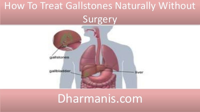 How To Treat Gallstones Naturally Without Surgery