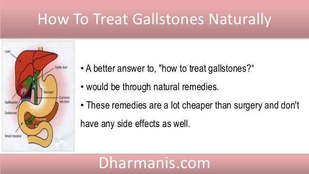 How To Treat Gallstones Naturally How To Treat Gallstones Naturally