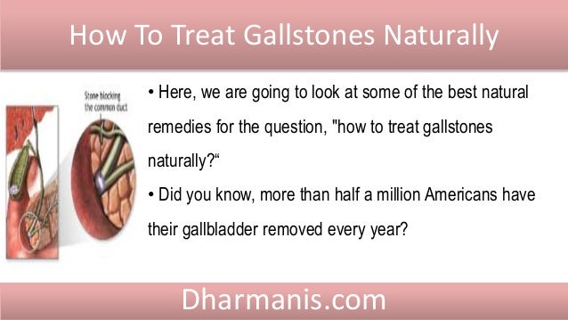 how to your without treats how to treat gallstones naturally without surgery how to your without treats how to treat gallstones naturally without surgery