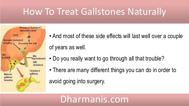 How to treat a gallstone
