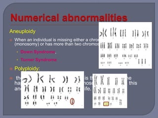 Aneuploidy
 When an individual is missing either a chromosome from a pair
(monosomy) or has more than two chromosomes of a pair (trisomy).
• Down Syndrome,
• Turner Syndrome
 Polyploidy:
 the number of chromosomes is the multiple of the
haploid number (i.e., 23 chromosomes). Usually, this
anomaly is incompatible with life.
 