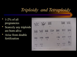 Triploidy and Tetraploidy
• 1-2% of all
pregnancies
• Scarcely any triploids
are born alive
• Arise from double
fertilization
 