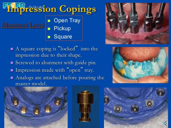 3.implant components and basic techniques3